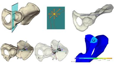 ����Ԫ����